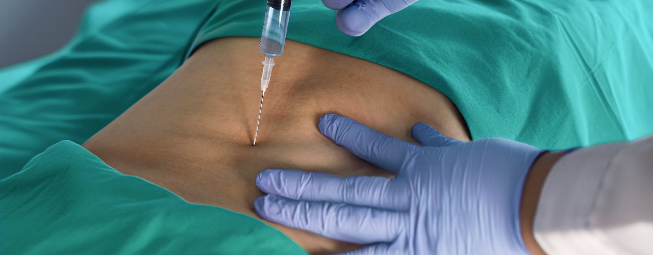 근본정형외과 SoDDA 주사치료 관련 설명 이미지