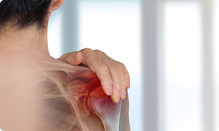 근본정형외과의원 어깨 질환의 주요원인