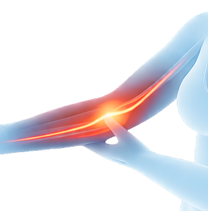 상지에 발생하는 대표적인 질환 이미지