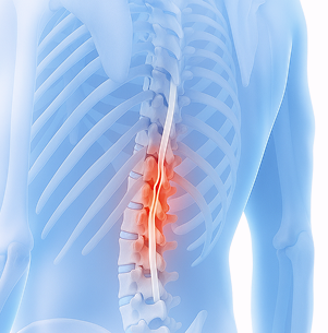 목, 허리에 발생하는 대표적인 질환 이미지
