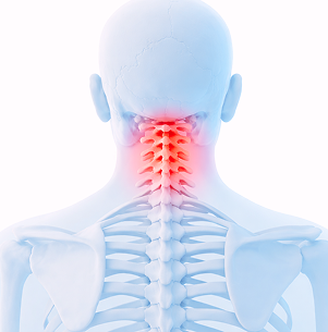 목, 허리에 발생하는 대표적인 질환 이미지