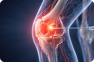 근본정형외과 신경회복주사 장점 이미지