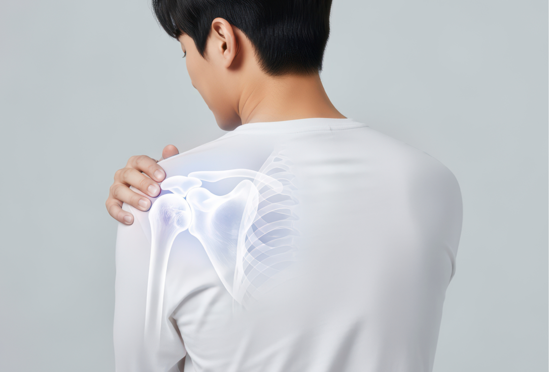 골절치유 치료  이미지